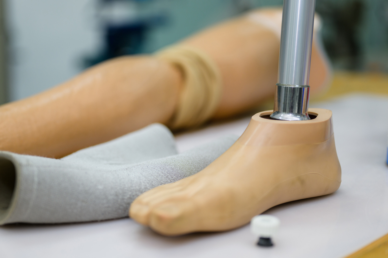 Prosthetic leg with foot and socket: Close-up of a prosthetic leg with a foot and socket, alongside a sock and a small white object, on a light-colored surface.
